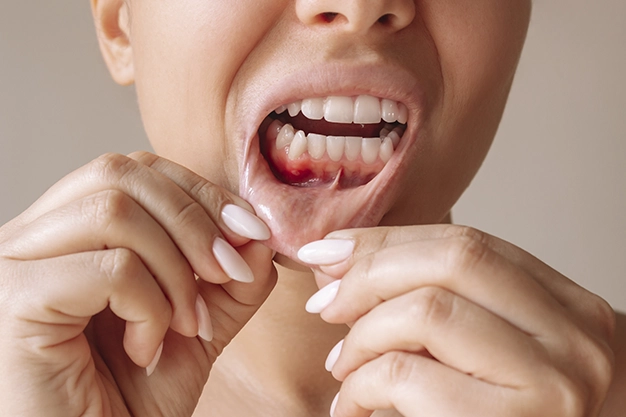 Periodontia